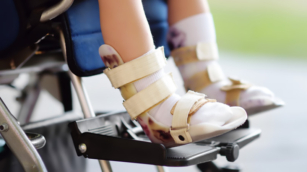 Pediatrik Ortopedi Nedir