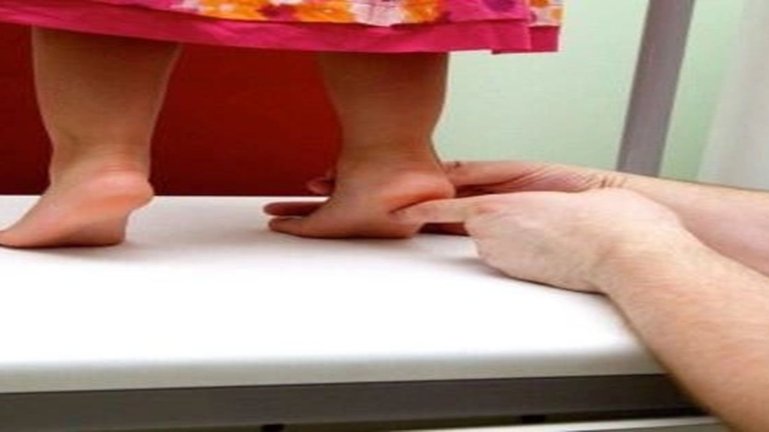 ما هو مرض كولر؟