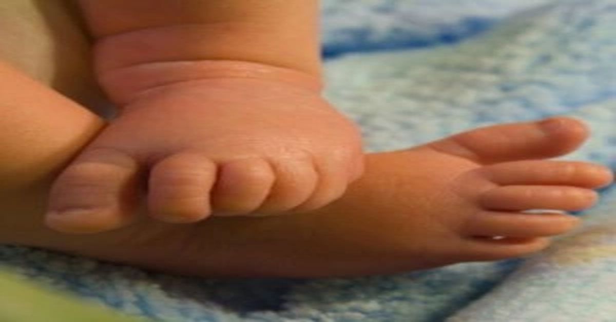 جراحة إصبع المطرقة جراحة إصبع المطرقة