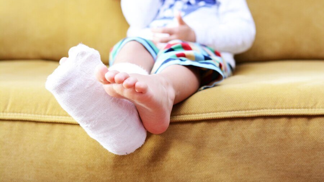 كسر الإجهاد عند الأطفال