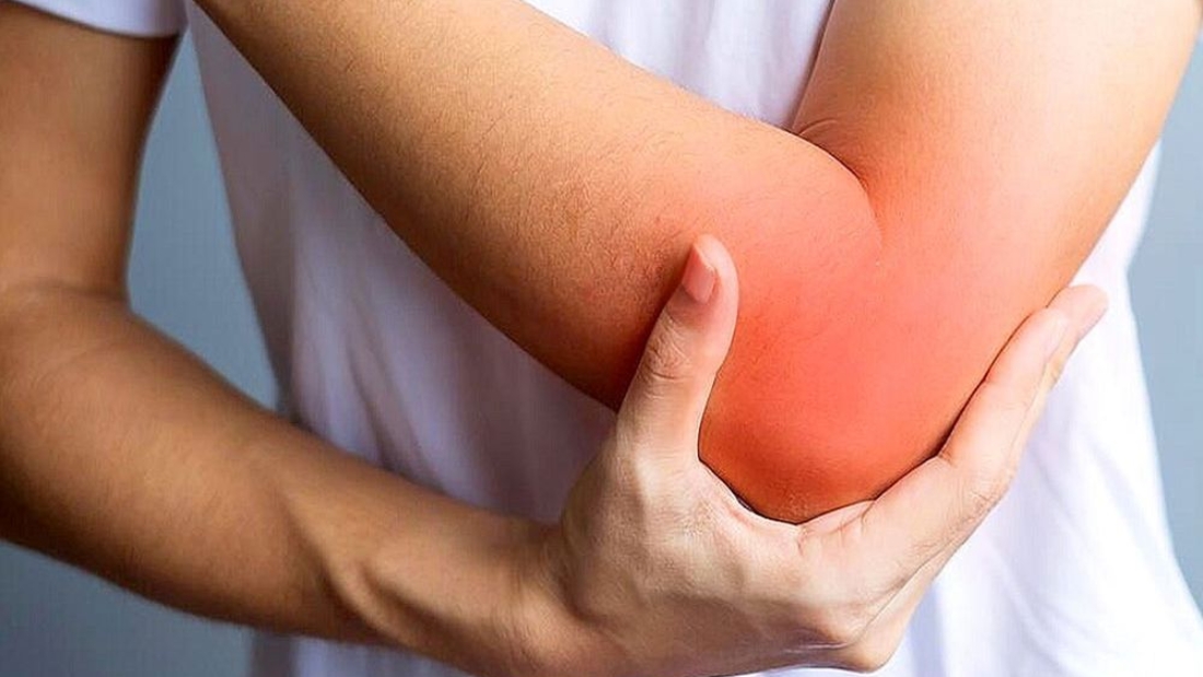 Теннисный локоть