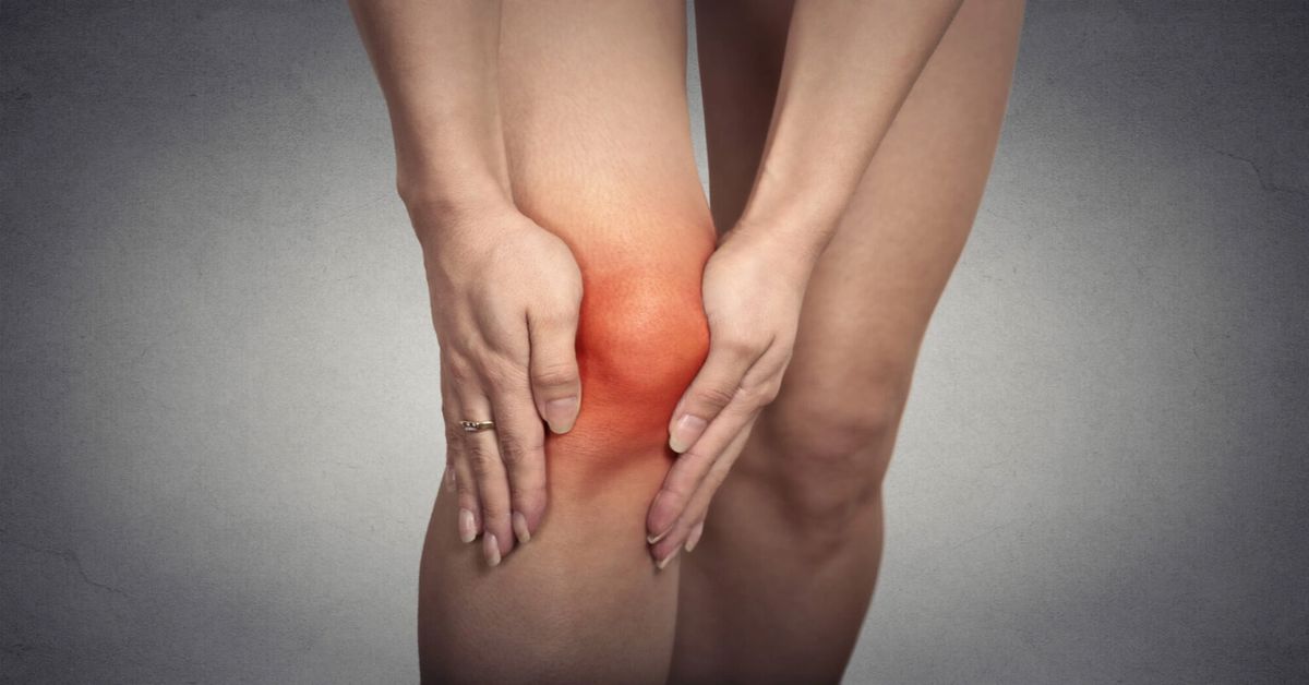 What is Kneecap Dislocation? What is Kneecap Dislocation?