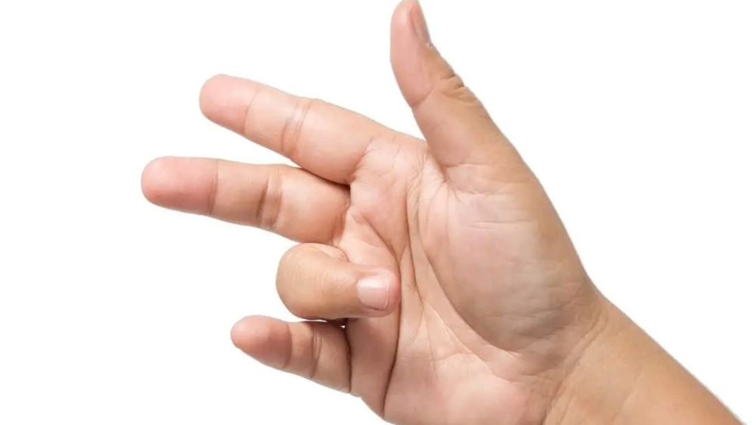 Trigger Finger Treatment