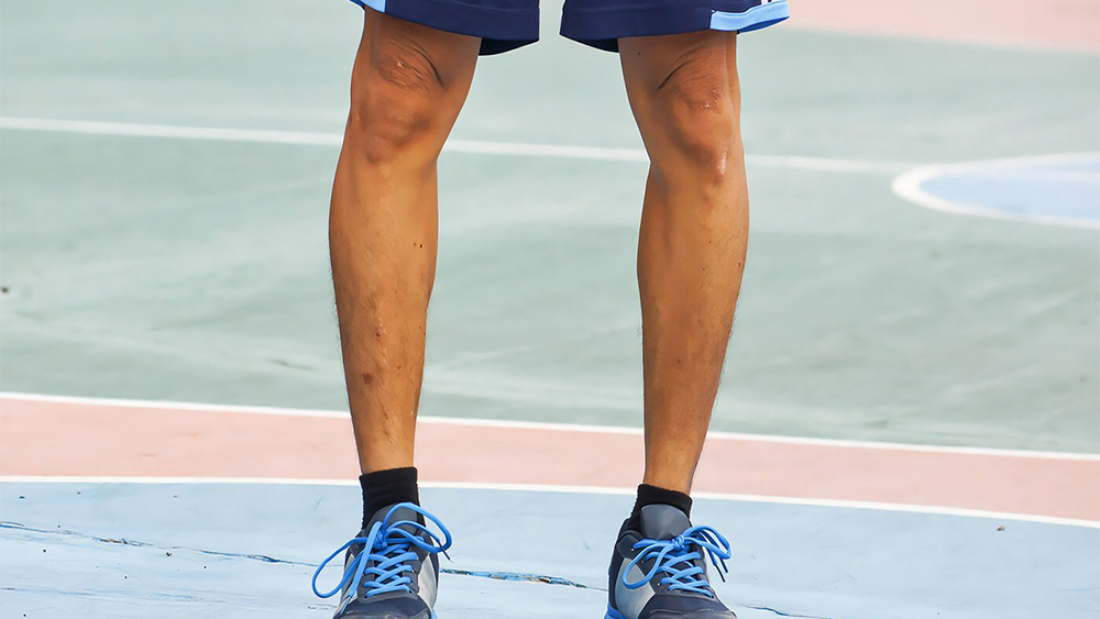 Blount's Disease Treatment