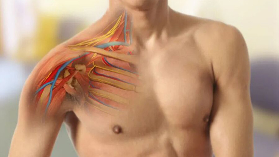 Brakial Pleksus Felci Nedir?