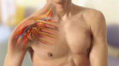 Brakial Pleksus Felci Nedir?