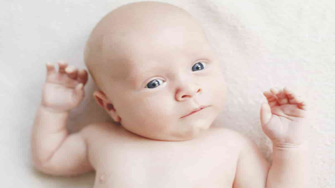 Tortikollis Tedavisi