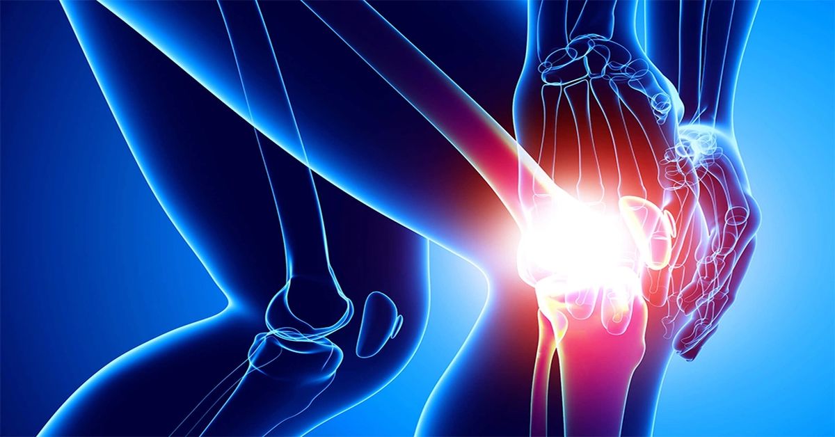 Diz Kapağı Çıkığı Tedavisi Diz Kapağı Çıkığı Tedavisi