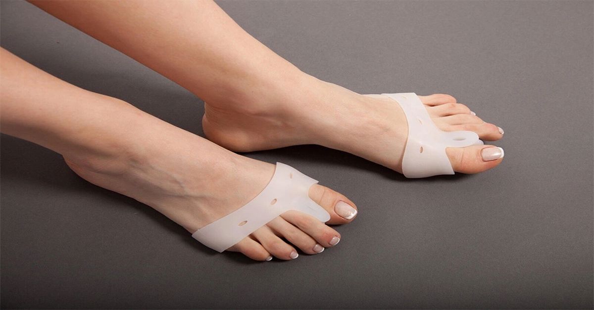 Halluks Valgus Ameliyatı Halluks Valgus Ameliyatı