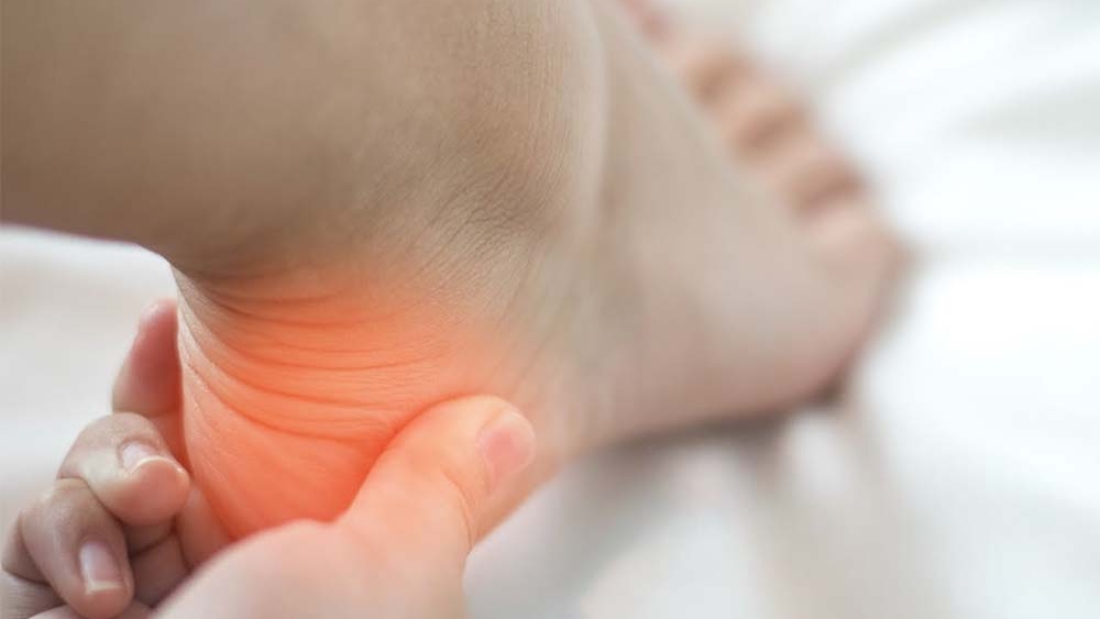 Kalkaneal Apofizit Nedir?