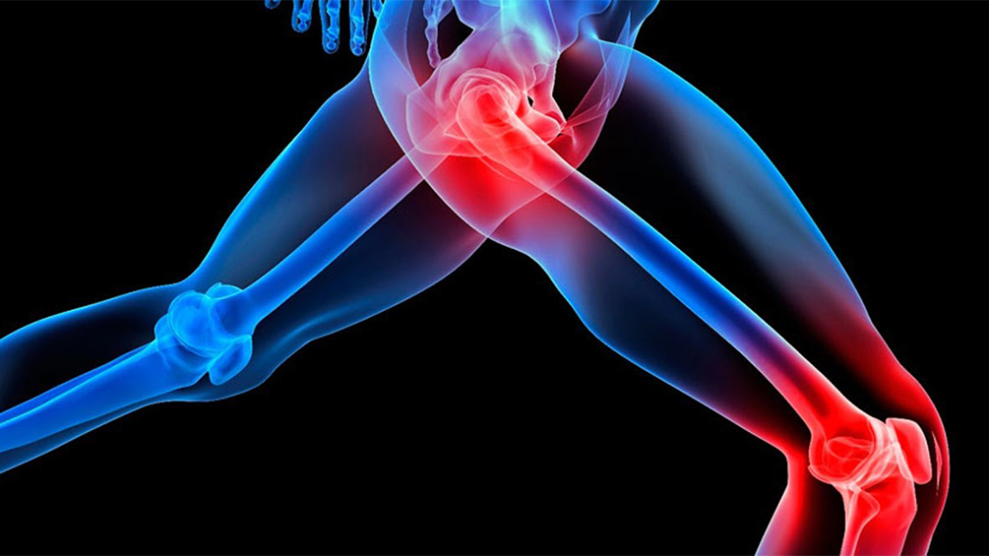 Osteokondritis Dissekans Tedavisi