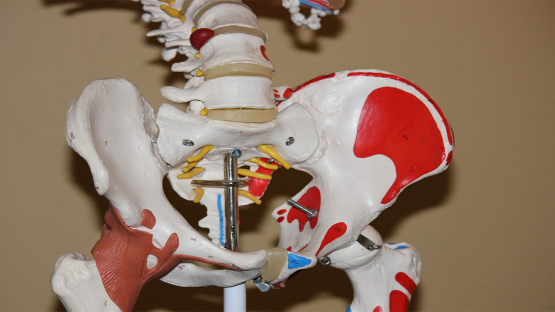 Perthes Disease Treatment