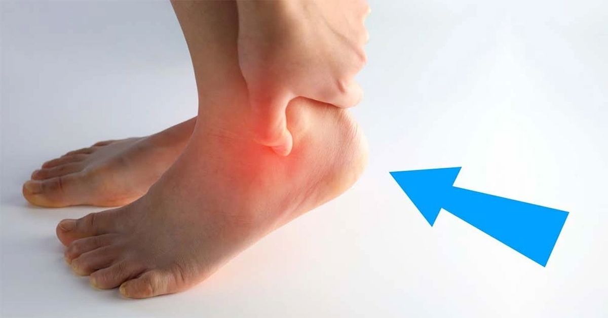 Tarsal Koalisyon Ameliyatı Tarsal Koalisyon Ameliyatı