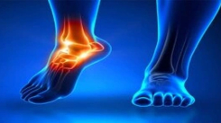 Tarsal Koalisyon Ameliyatı