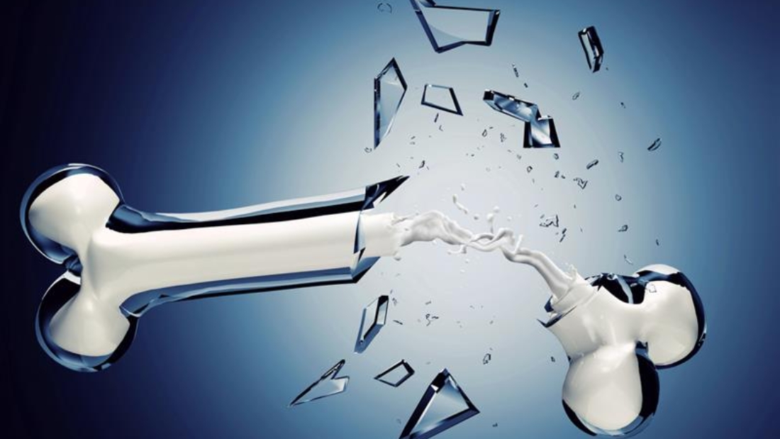 Cam Kemiği Hastalığı