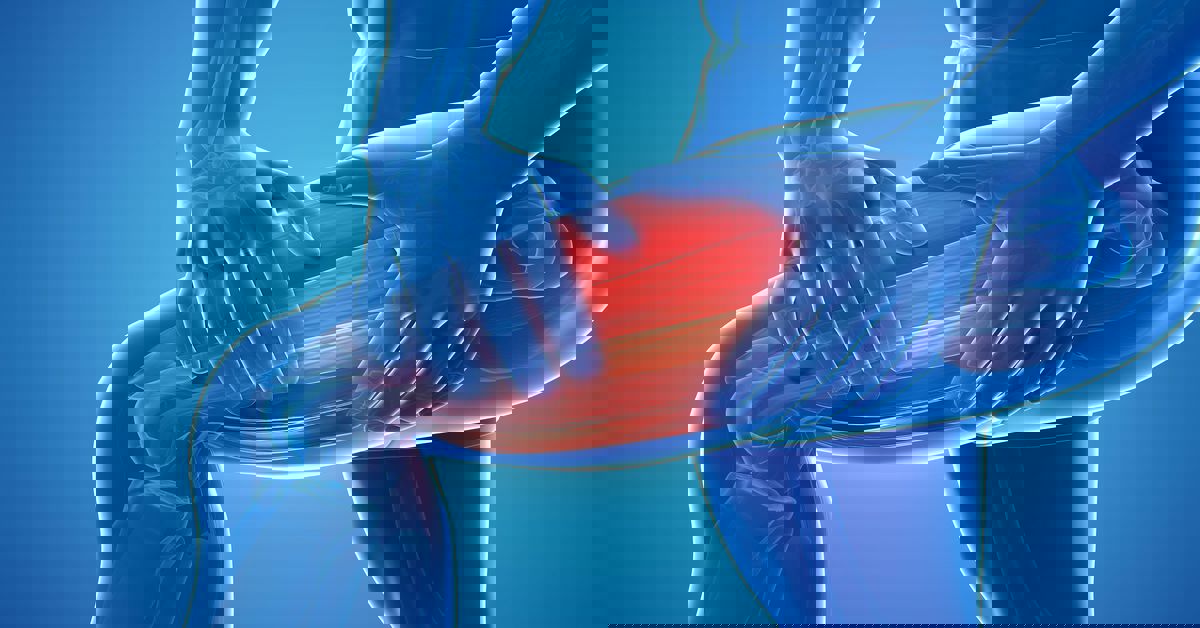 Kas Zayıflığı Kas Zayıflığı