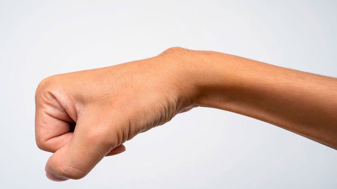 Kemik Kisti Tedavisi