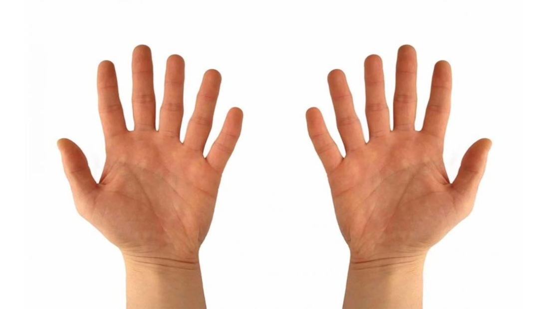 Polidaktili Nedir?
