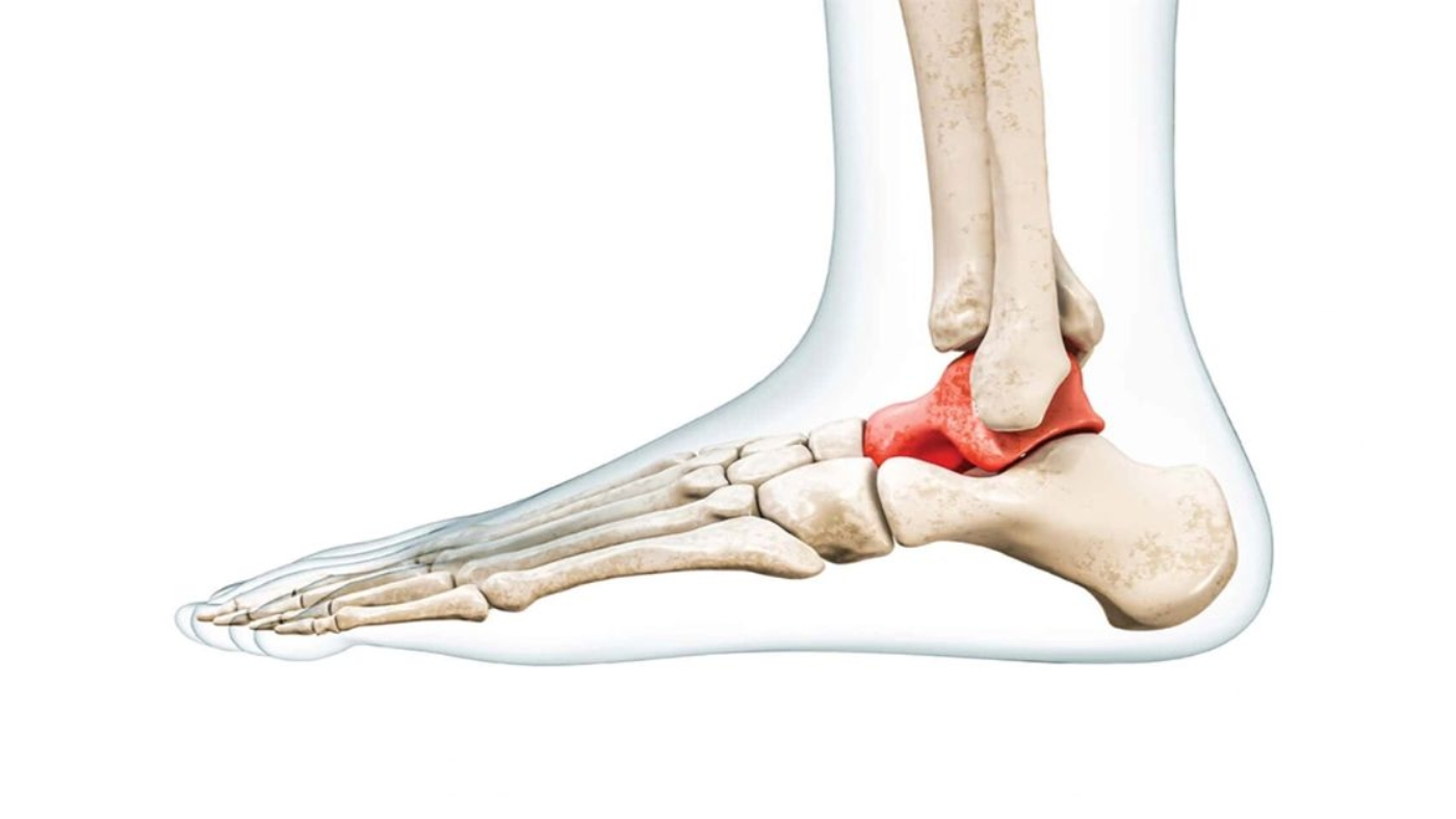 Tarsal Koalisyon Nedir?