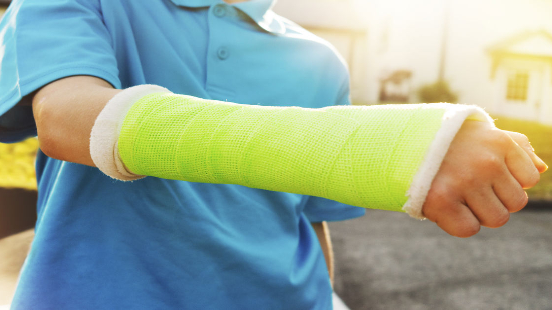 Çocuklarda Torus Kırığı