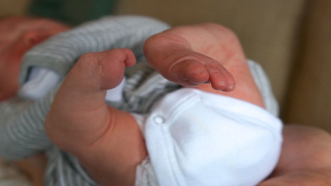 Tibial Hemimelia Tedavisi